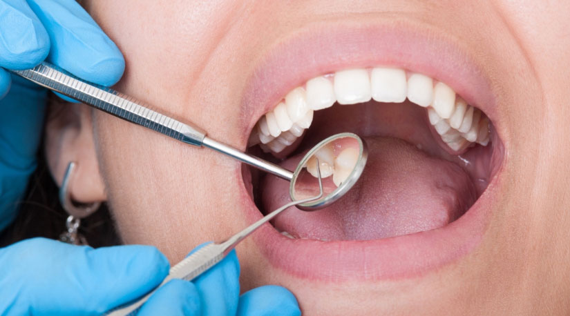 दाँत र गिजालाई कसरी सफा राख्ने?